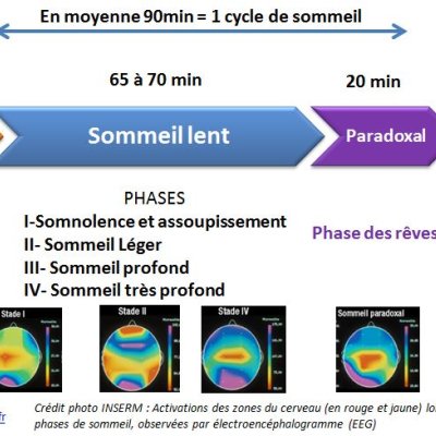 Retard de phase de sommeil Décalage de phase du sommeil